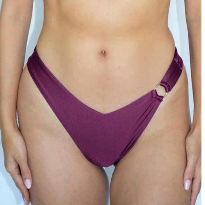 Bottom Estilo 10